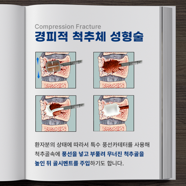 ae54a5094fdc8a364f99808d46f3eed2_1745456139_7742.png
